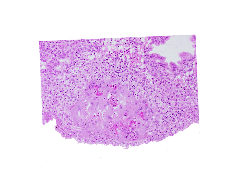 lumen of endometrial gland, maternal blood cells in trophoblast lacuna, syncytiotrophoblast, uterine cavity