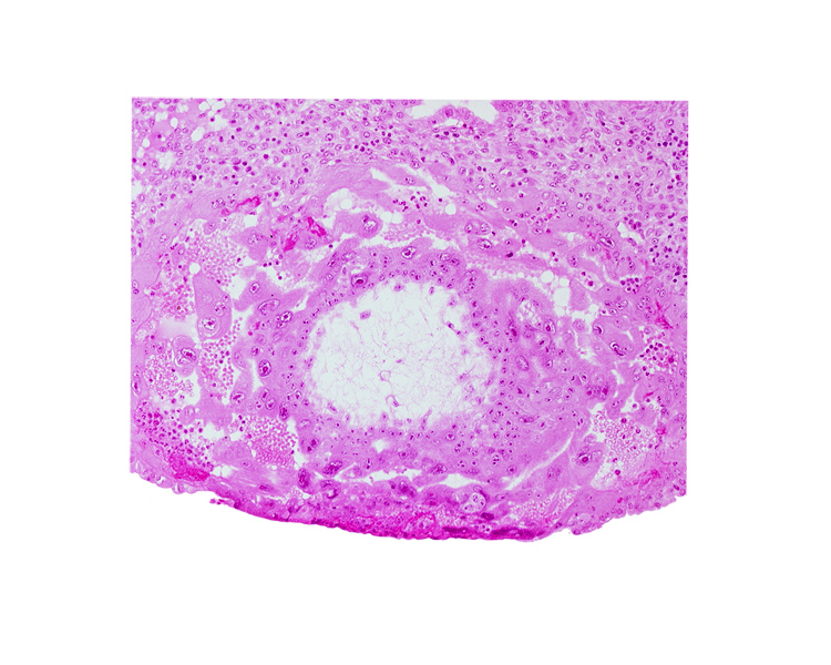 extra-embryonic reticulum, syncytiotrophoblast, uterine cavity