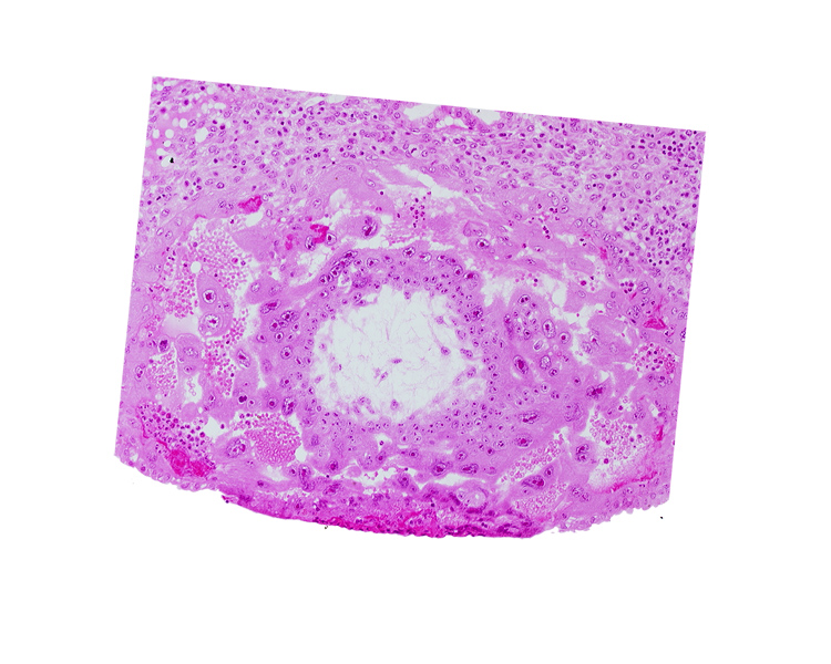 chorionic cavity, fibrous coagulum, syncytiotrophoblast, uterine cavity