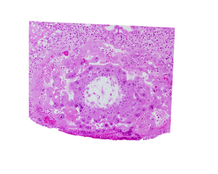 cytotrophoblast, syncytiotrophoblast, uterine cavity