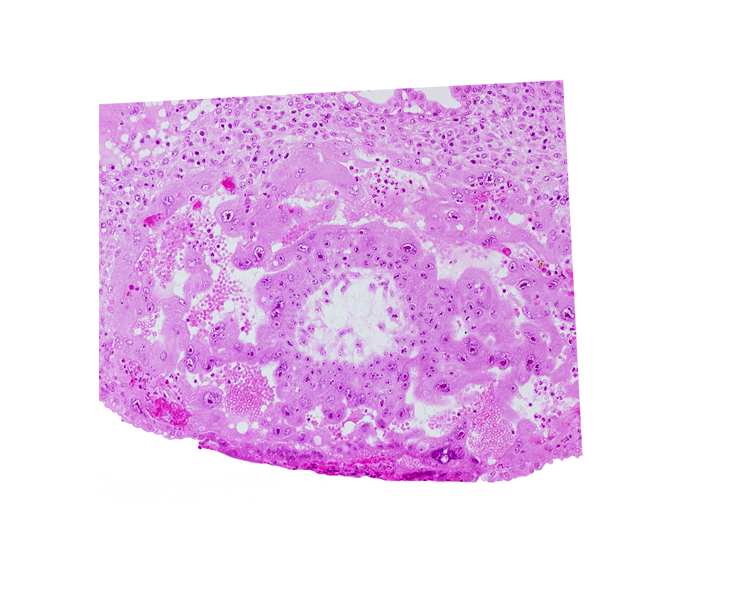 cytotrophoblast, syncytiotrophoblast, uterine cavity