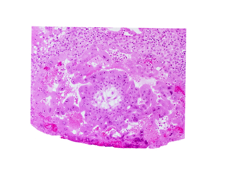 cytotrophoblast, edge of chorionic cavity, maternal blood cells in intercommunicating lacunae, syncytiotrophoblast