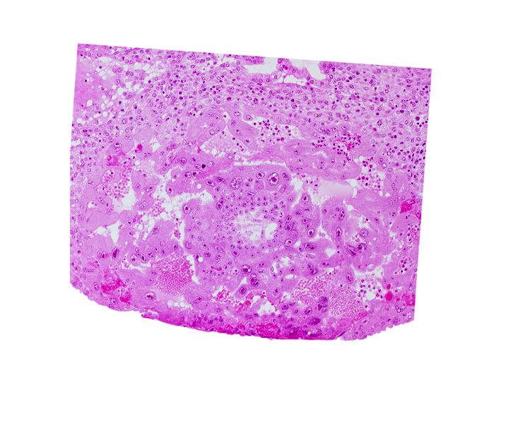 cytotrophoblast, edge of extra-embryonic reticulum, maternal blood cells in intercommunicating lacunae, syncytiotrophoblast