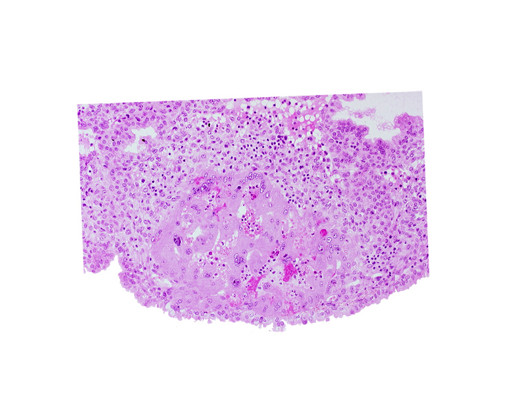 maternal blood cells in trophoblast lacuna, syncytiotrophoblast, uterine cavity