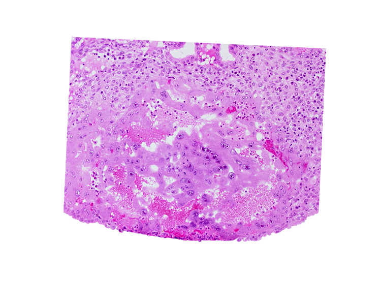 endometrial epithelium, lacunar vascular circle, syncytiotrophoblast, uterine cavity