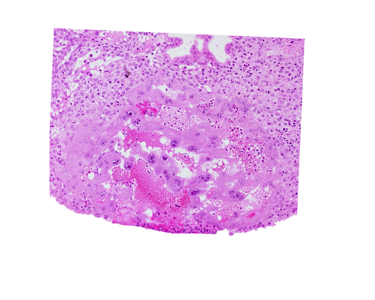 endometrial epithelium, lacunar vascular circle, maternal blood cells in trophoblast lacuna, syncytiotrophoblast, uterine cavity