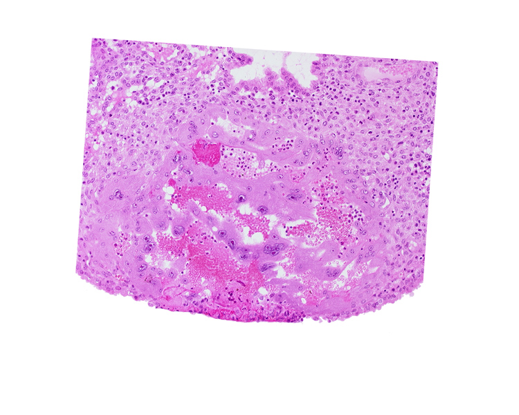 endometrial epithelium, endometrial stroma (decidua), lacunar vascular circle, maternal blood cells in trophoblast lacuna, syncytiotrophoblast, uterine cavity