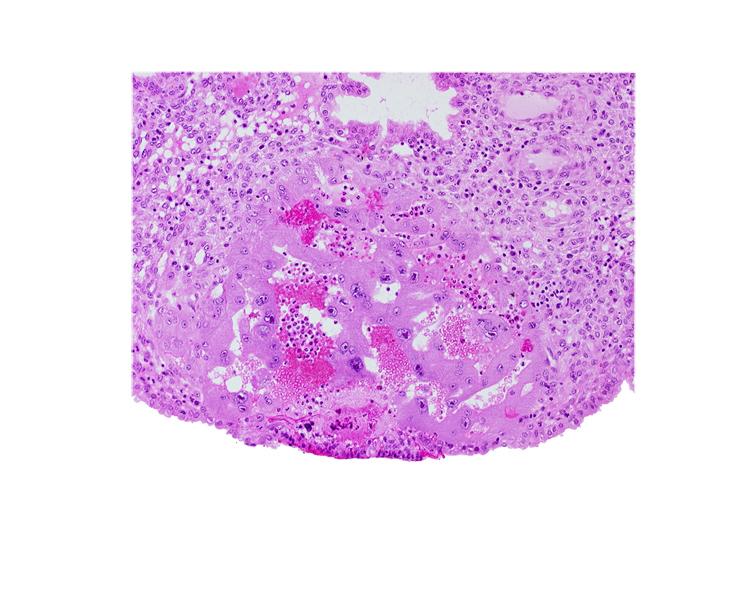 endometrial epithelium, endometrial sinusoid, lacunar vascular circle, lumen of endometrial gland, uterine cavity