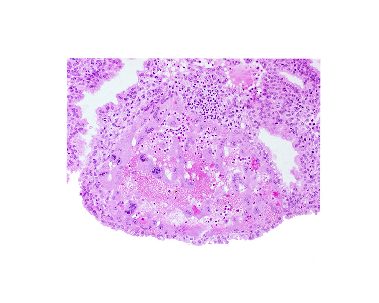 endometrial epithelium, maternal blood cells in trophoblast lacuna, mouth of endometrial gland, syncytiotrophoblast