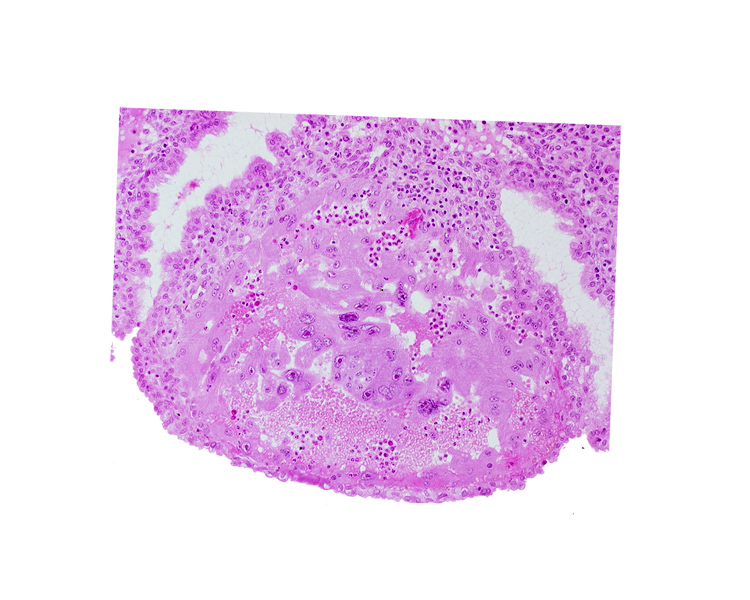 endometrial epithelium, lumen of endometrial gland, maternal blood cells in trophoblast lacuna, mouth of endometrial gland