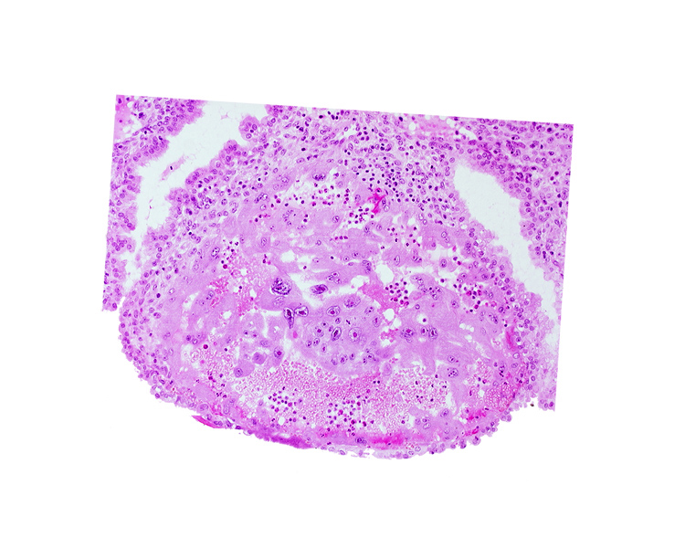 lumen of endometrial gland, maternal blood cells in trophoblast lacuna, syncytiotrophoblast