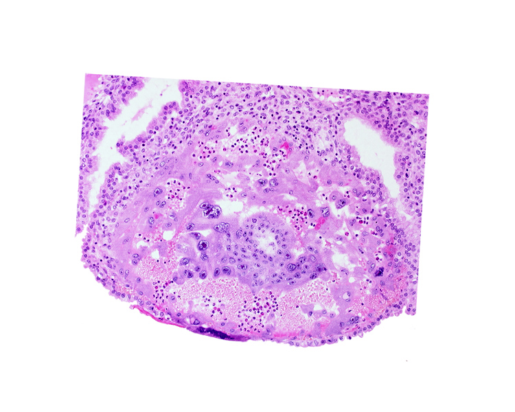 disrupted endometrial epithelium, edge of chorionic cavity, maternal blood cells in trophoblast lacuna, syncytiotrophoblast