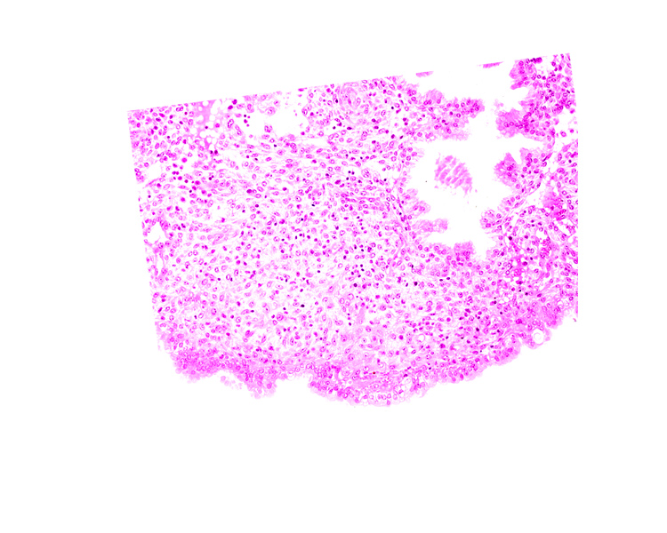 edge of syncytiotrophoblast, endometrial stroma (decidua), intact endometrial epithelium, lumen of endometrial gland, uterine cavity