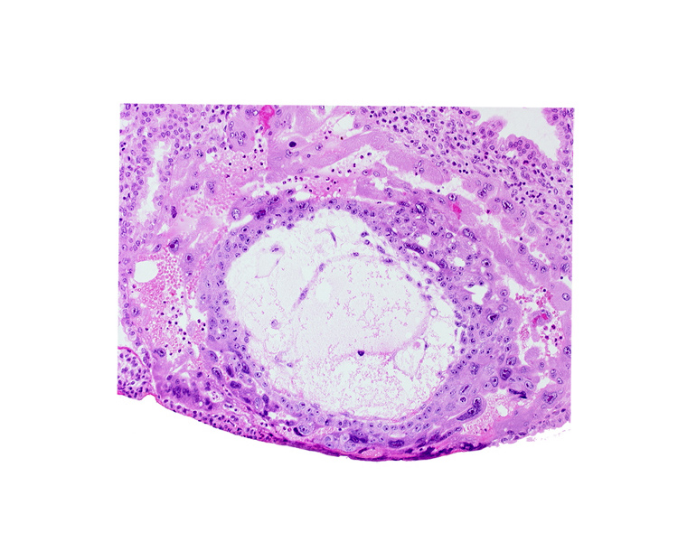 chorionic cavity, cytotrophoblast, edge of primary umbilical vesicle cavity, exocoelomic (Heuser's) membrane, extra-embryonic mesoblast, lacunar vascular circle