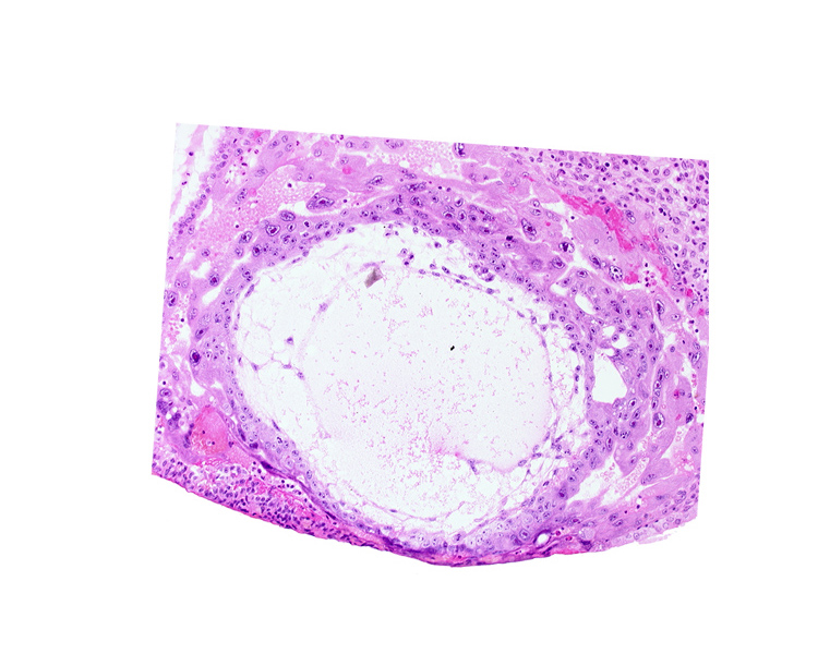 chorionic cavity, cytotrophoblast, extra-embryonic mesoblast, fibrous coagulum, primary umbilical vesicle cavity, syncytiotrophoblast, uterine cavity