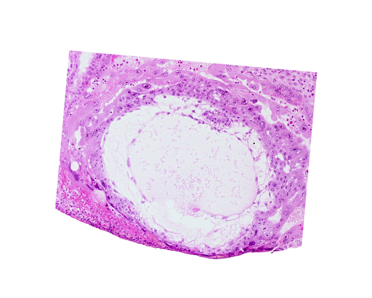 chorionic cavity, epiblast, exocoelomic (Heuser's) membrane, extra-embryonic mesoblast, hypoblast, primary umbilical vesicle cavity