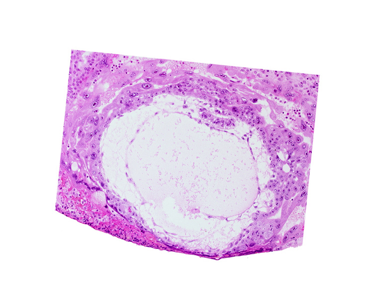 chorionic cavity, edge of amniotic cavity, extra-embryonic mesoblast