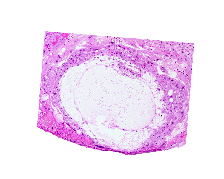 amniotic cavity, chorionic cavity, extra-embryonic mesoblast, primary umbilical vesicle cavity