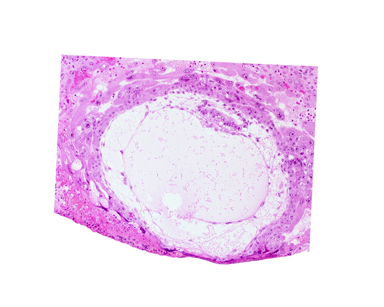 amniotic cavity, chorionic cavity, epiblast vacuole, hypoblast, primary umbilical vesicle cavity