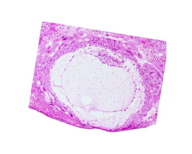 amniotic cavity, chorionic cavity, epiblast vacuole, hypoblast, primary umbilical vesicle cavity