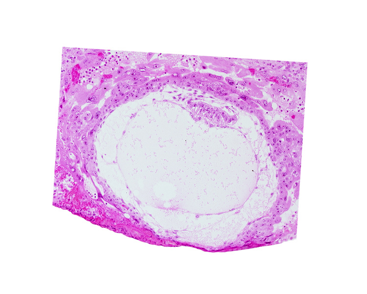 amniotic cavity, angioblastic tissue of mesoblast, chorionic cavity, condensed extra-embryonic mesoblasts at caudal end of embryonic disc, epiblast vacuole, exocoelomic (Heuser's) membrane, hypoblast, presumptive prechordal plate