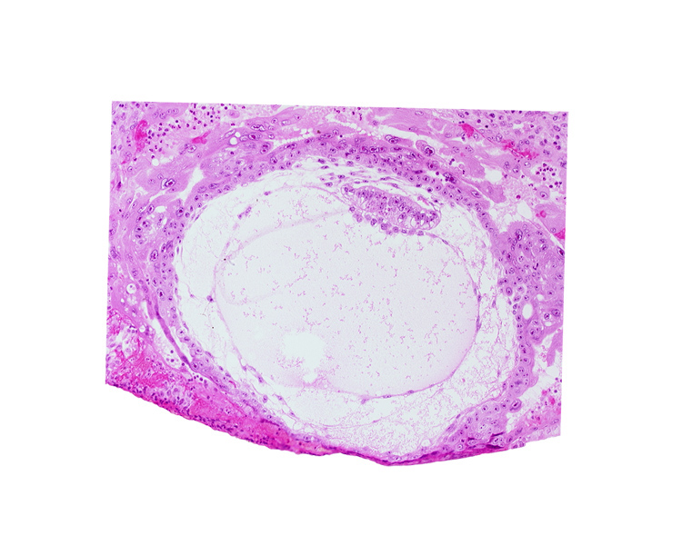 amniotic cavity, angioblastic tissue of mesoblast, chorionic cavity, condensed extra-embryonic mesoblasts at caudal end of embryonic disc, epiblast vacuole, exocoelomic (Heuser's) membrane