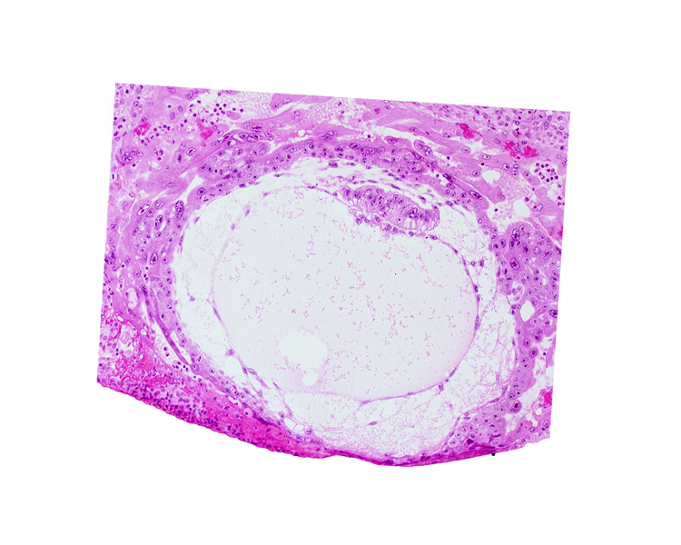 amniotic cavity, angioblastic tissue of mesoblast, chorionic cavity, epiblast vacuole, exocoelomic (Heuser's) membrane