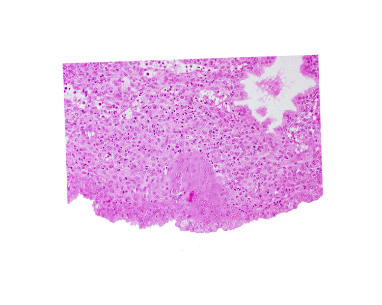 intact endometrial epithelium, lumen of endometrial gland, syncytiotrophoblast, uterine cavity