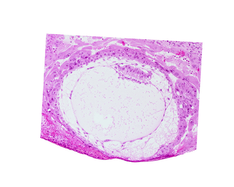 amniotic cavity, epiblast vacuole, fibrous coagulum, lacunar vascular circle