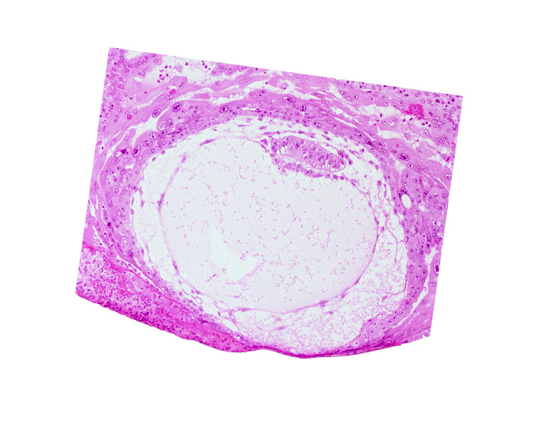 amniotic cavity, chorionic cavity, epiblast vacuole, fibrous coagulum, lacunar vascular circle, presumptive prechordal plate, primary umbilical vesicle cavity