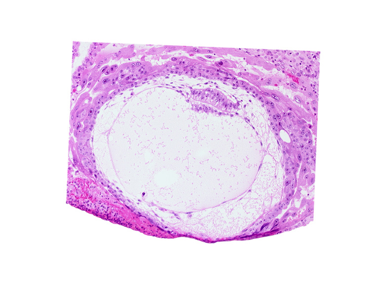 amnion, amniotic cavity, chorion, chorionic cavity, condensed extra-embryonic mesoblasts, definitive exocoelomic (Heuser's) membrane, extra-embryonic mesoblast, extra-embryonic reticulum, hypoblast, lacunar vascular circle, primary umbilical vesicle cavity, uterine cavity