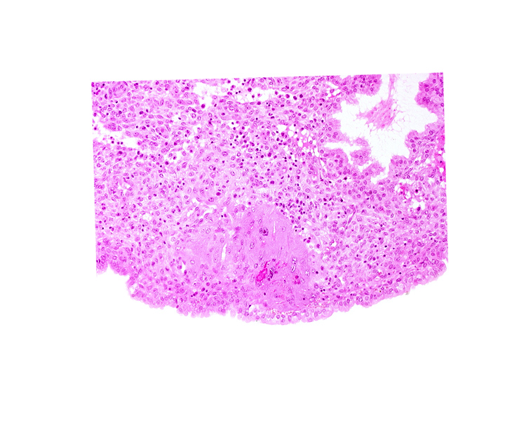 endometrial epithelium, lumen of endometrial gland, syncytiotrophoblast