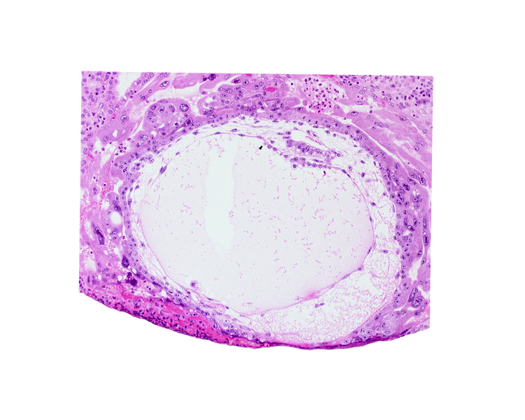 chorionic cavity, embryonic disc, epiblast vacuole, extra-embryonic mesoblast, primary umbilical vesicle cavity