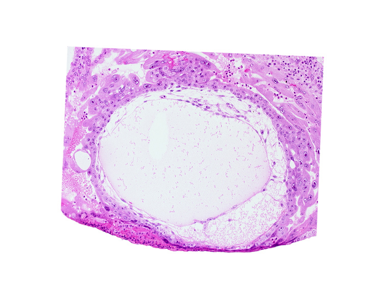 chorion, chorionic cavity, exocoelomic (Heuser's) membrane, primary umbilical vesicle cavity