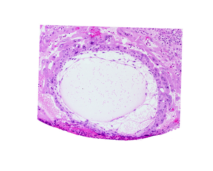 chorionic cavity, cytotrophoblast, lacunar vascular circle, primary umbilical vesicle cavity, syncytiotrophoblast