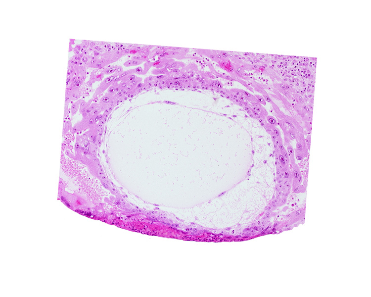 chorionic cavity, definitive exocoelomic (Heuser's) membrane, lacunar vascular circle, uterine cavity