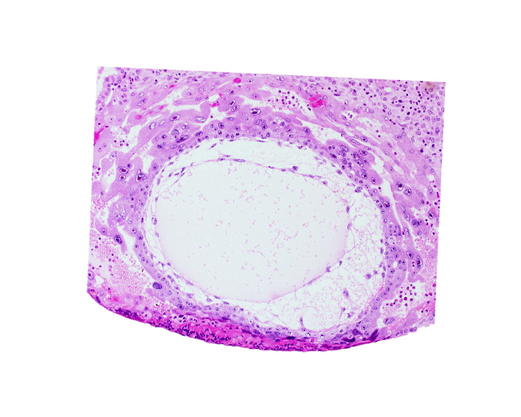 chorionic cavity, primary umbilical vesicle cavity, syncytiotrophoblast, uterine cavity