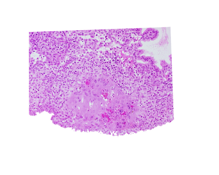 endometrial epithelium, lumen of endometrial gland, syncytiotrophoblast, uterine cavity