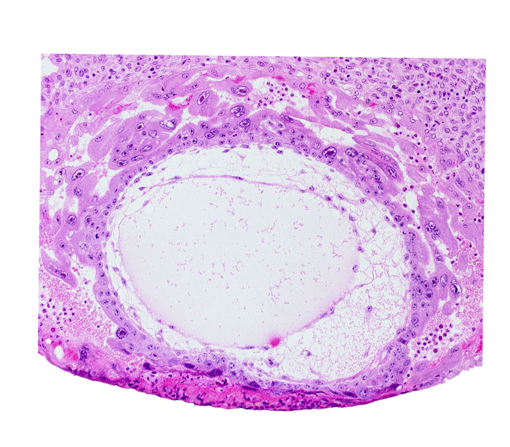 chorionic cavity, definitive exocoelomic (Heuser's) membrane, primary umbilical vesicle cavity