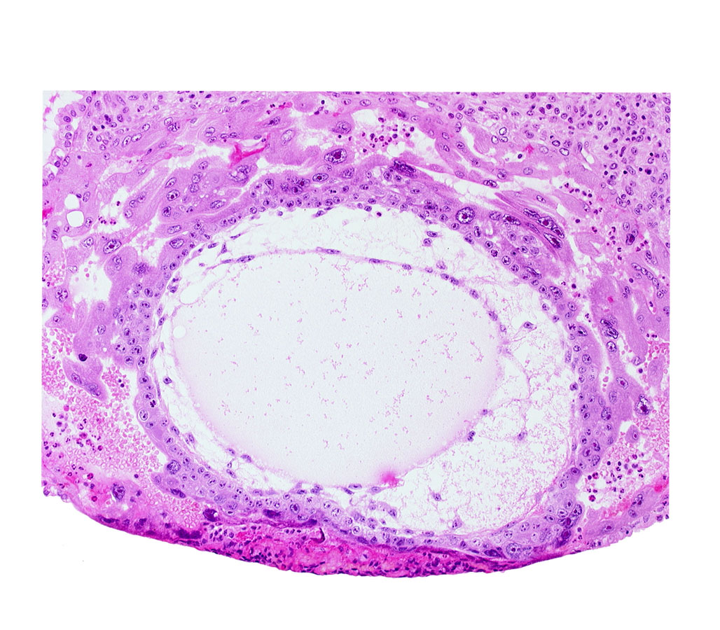 chorionic cavity, definitive exocoelomic (Heuser's) membrane, primary umbilical vesicle cavity, syncytiotrophoblast, uterine cavity