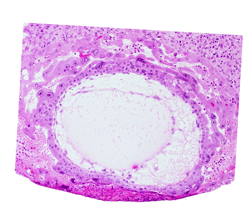 chorionic cavity, definitive exocoelomic (Heuser's) membrane, primary umbilical vesicle cavity, syncytiotrophoblast, uterine cavity