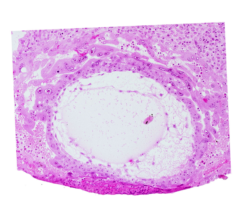 chorionic cavity, definitive exocoelomic (Heuser's) membrane, extra-embryonic mesoblast, primary umbilical vesicle cavity