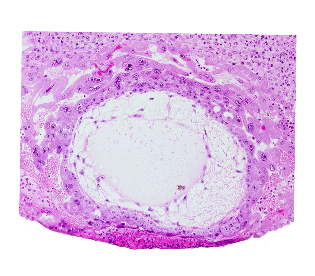 chorionic cavity, definitive exocoelomic (Heuser's) membrane, extra-embryonic mesoblast, primary umbilical vesicle cavity