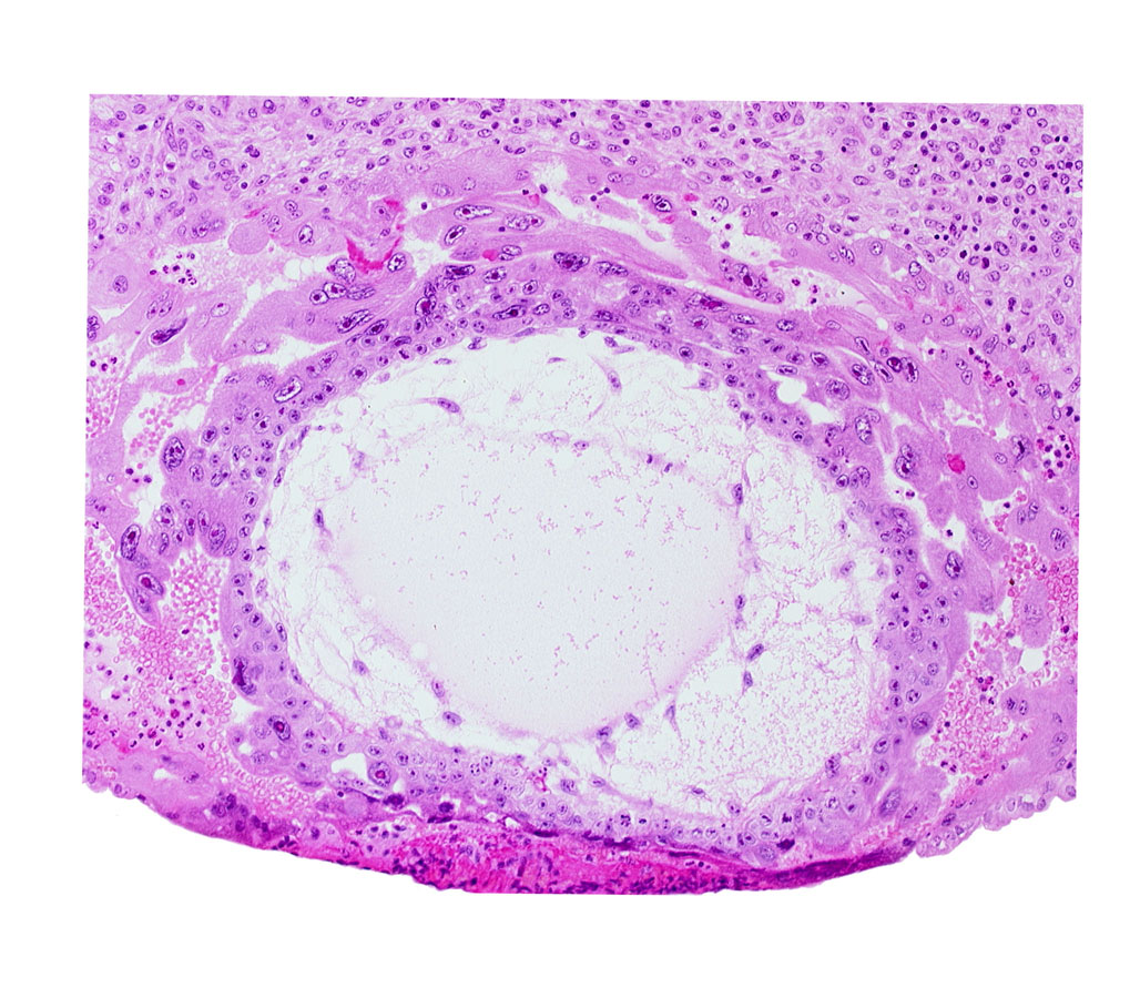 definitive exocoelomic (Heuser's) membrane, extra-embryonic mesoblast, primary umbilical vesicle cavity