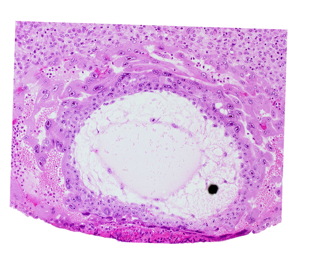 chorionic cavity, definitive exocoelomic (Heuser's) membrane, primary umbilical vesicle cavity