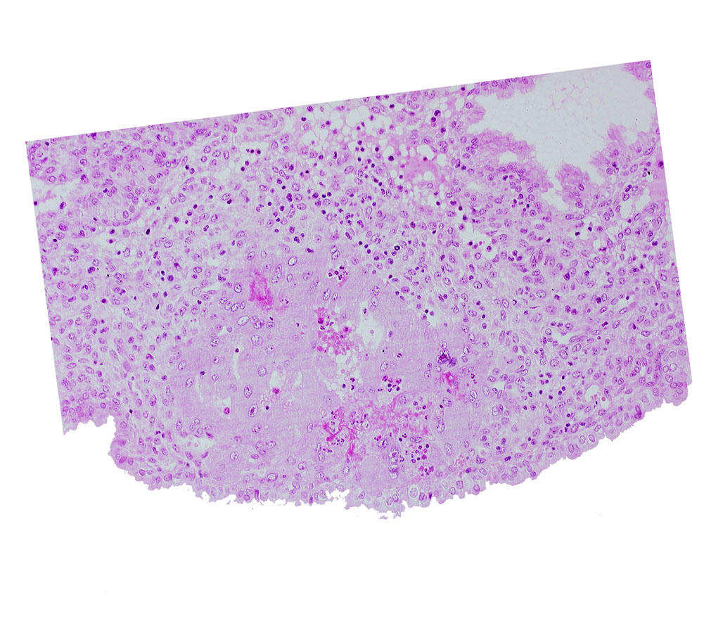 endometrial epithelium, lumen of endometrial gland, maternal blood cells in trophoblast lacuna, uterine cavity