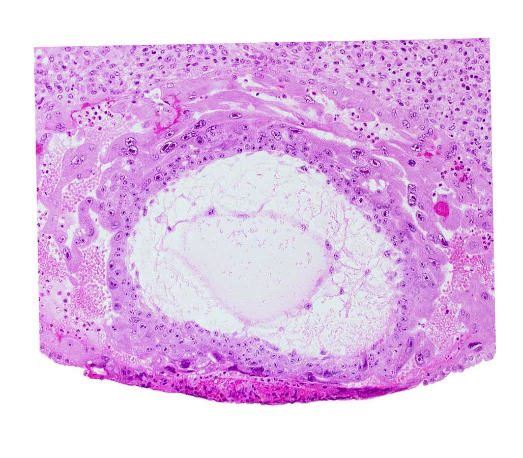 chorionic cavity, syncytiotrophoblast, uterine cavity