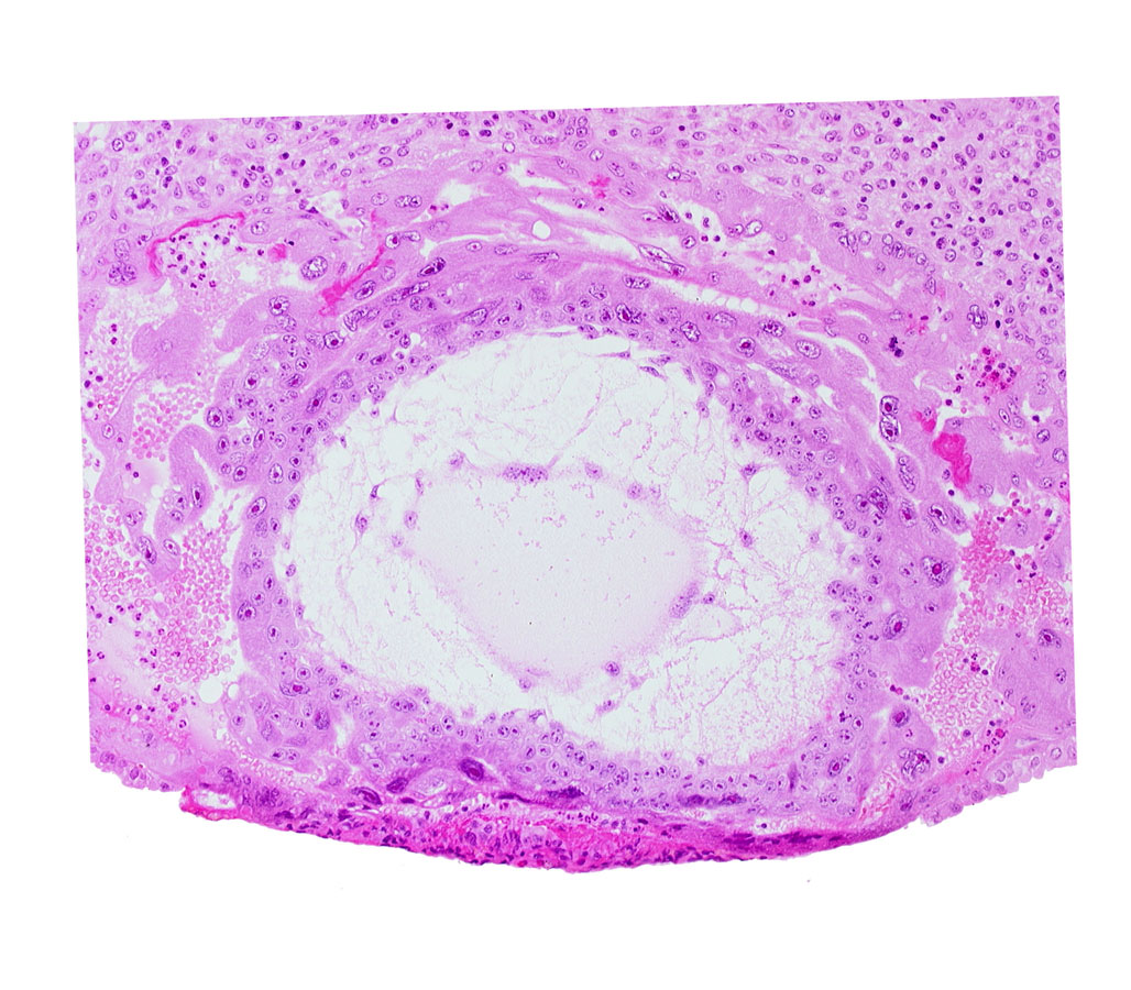 chorionic cavity, syncytiotrophoblast, uterine cavity