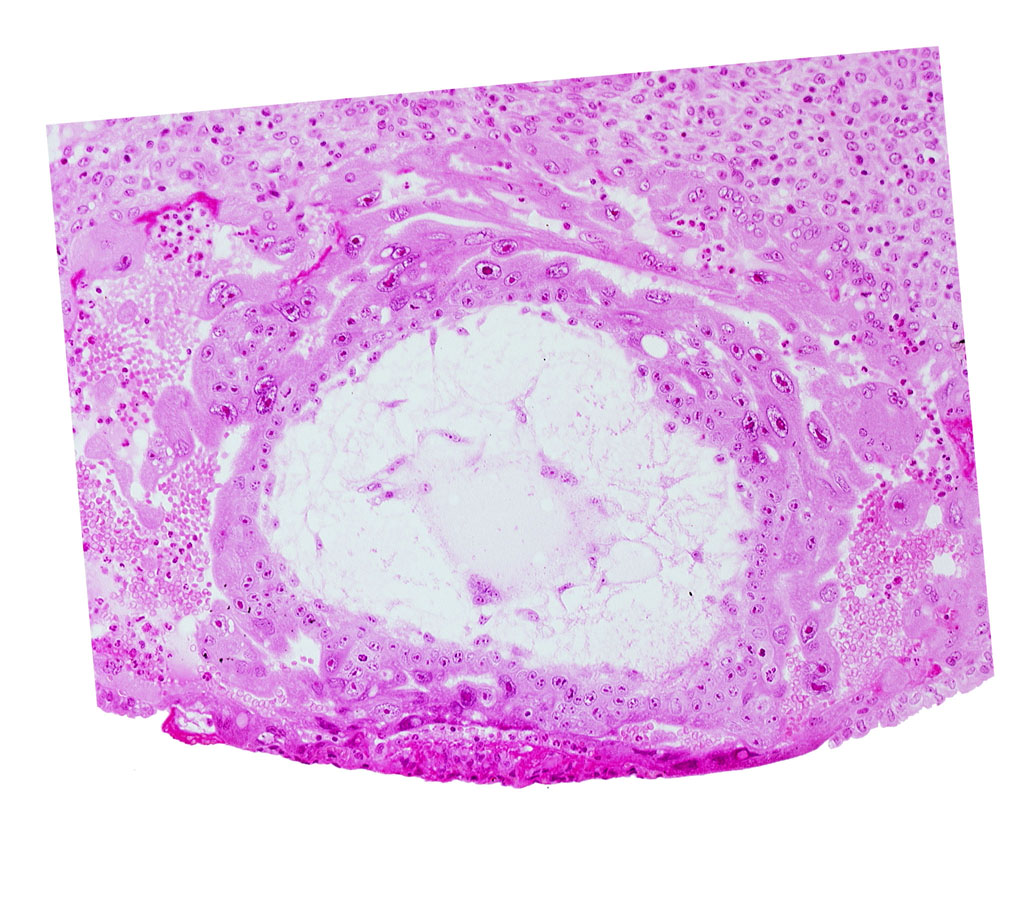 chorionic cavity, extra-embryonic mesoblast, fibrous coagulum, syncytiotrophoblast, uterine cavity