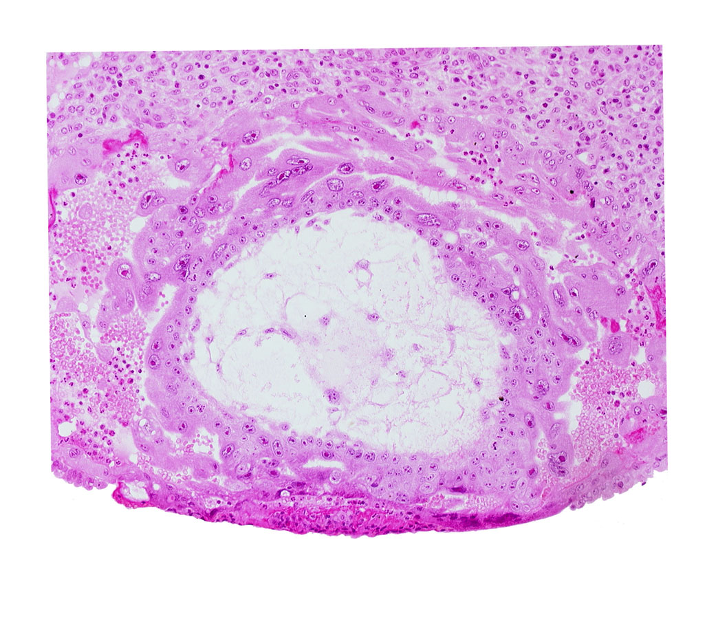 extra-embryonic mesoblast, fibrous coagulum, syncytiotrophoblast